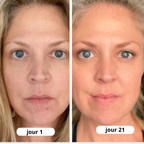 Rituel LED 2-en-1 Anti-Cernes — Regard Lisse & Lumineux