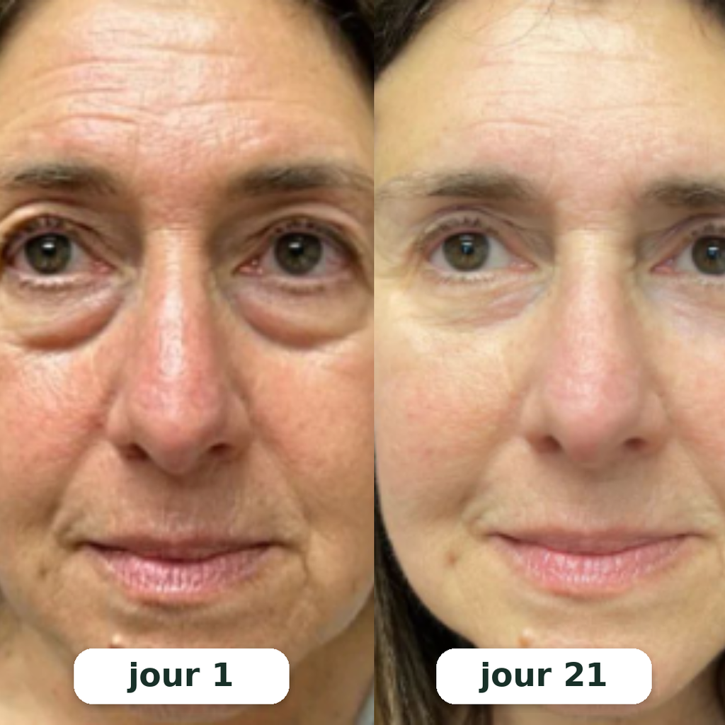 Rituel LED 2-en-1 Anti-Cernes — Regard Lisse & Lumineux