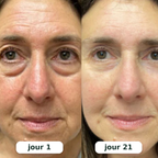 Rituel LED 2-en-1 Anti-Cernes — Regard Lisse & Lumineux