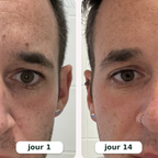 Rituel LED 2-en-1 Anti-Cernes — Regard Lisse & Lumineux