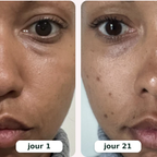 Rituel LED 2-en-1 Anti-Cernes — Regard Lisse & Lumineux