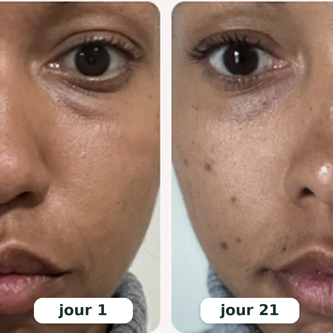 Rituel LED 2-en-1 Anti-Cernes — Regard Lisse & Lumineux